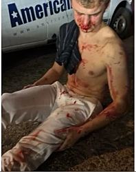 Подросткам-нападавшим на бывшего сотрудника DOGE  предъявлены дополнительные обвинения