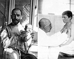 Эрнст Моро – доктор, который спас тысячи жизней, благодаря обычному морковному супу.