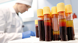 Россия сравнялась с Африкой по распространению ВИЧ