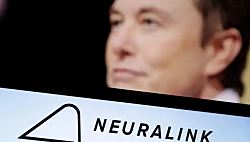 Маск заявил о вживлении мозгового чипа второму человеку